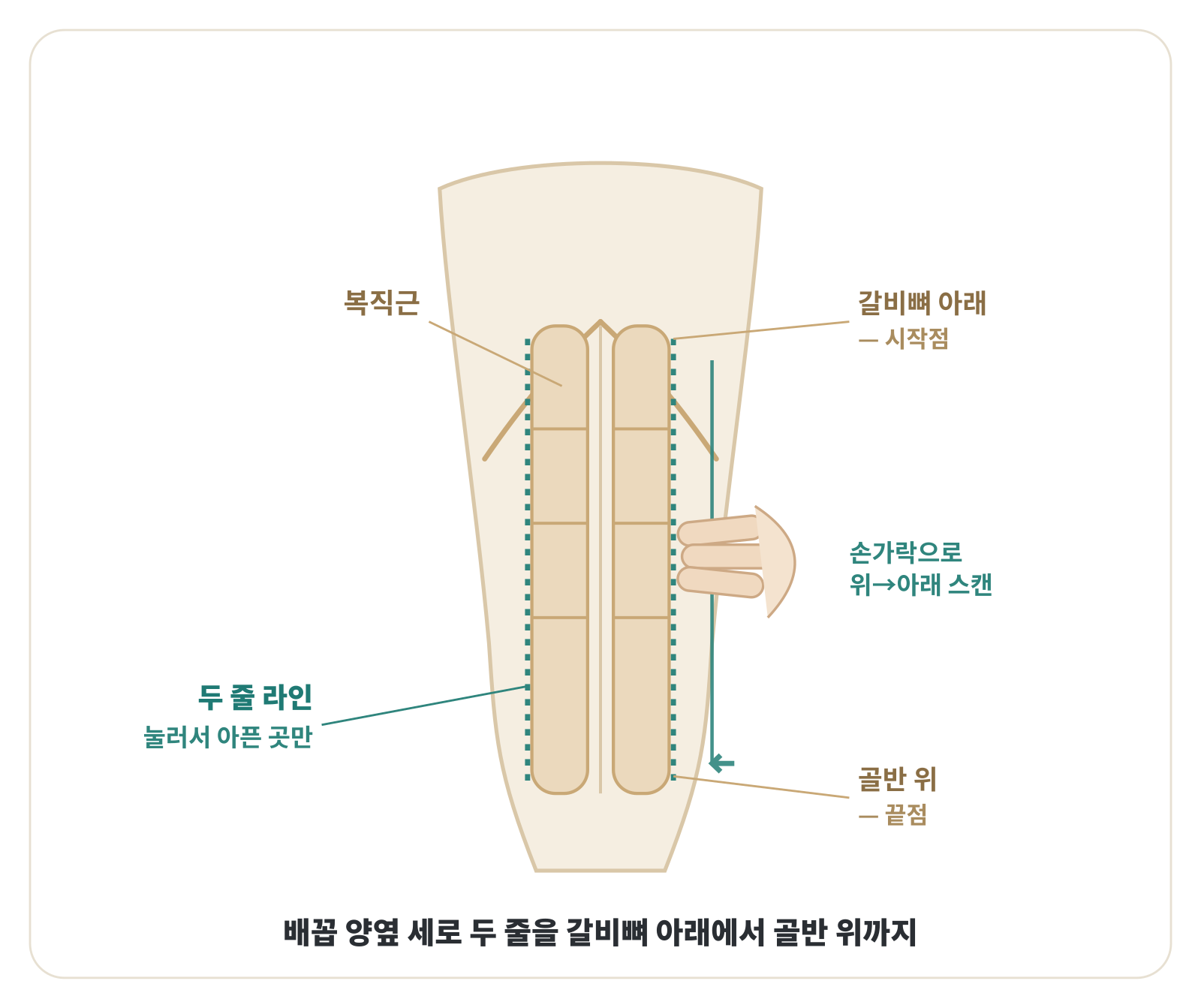 제6화_그림3_복직근라인.png